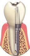 Desert Ridge Implant and Oral Surgery